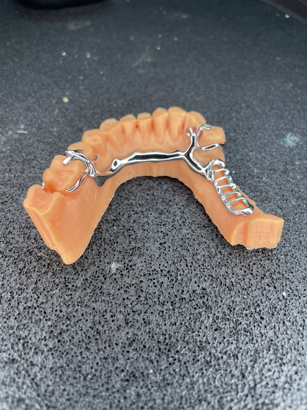 Estructura de PPR en cromo cobalto superior sobre modelo impreso en 3D, vista lateral